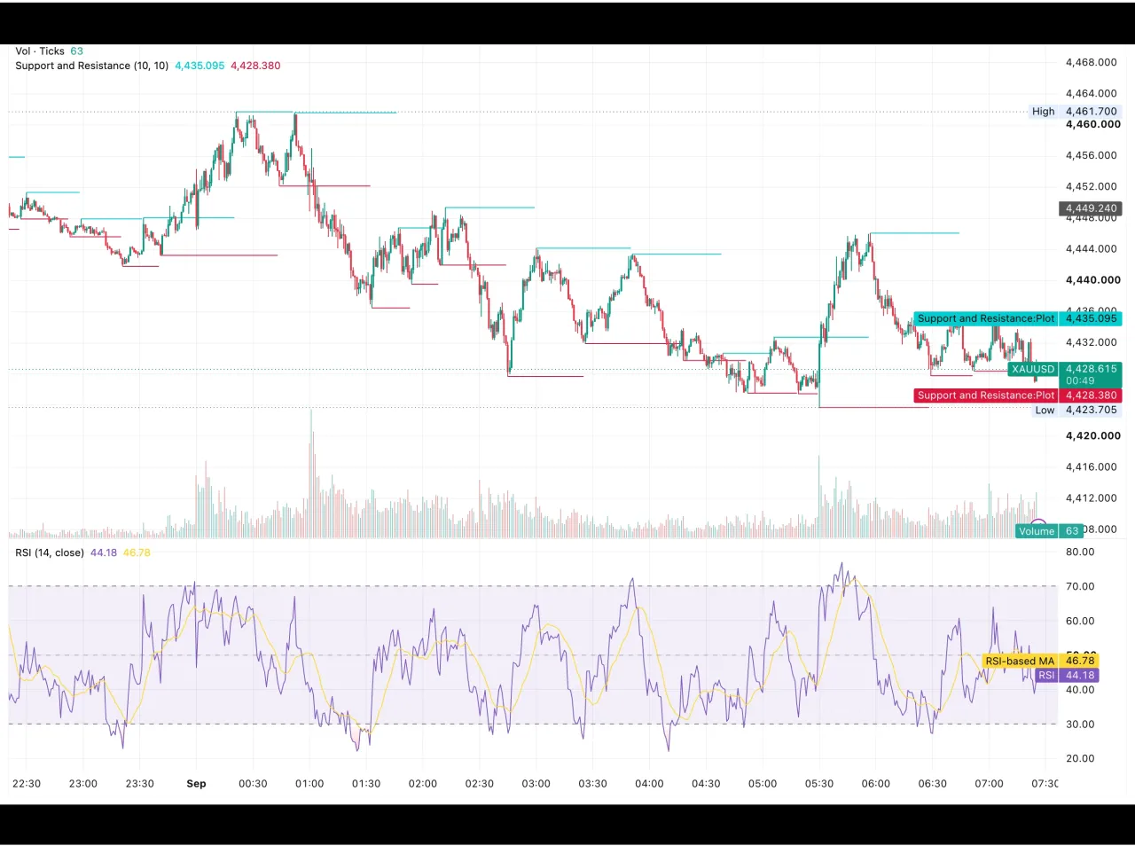 شارت تحليل الذهب اليوم XAUUSD 1 سبتمبر 2026